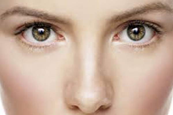 RHINOPLASTY